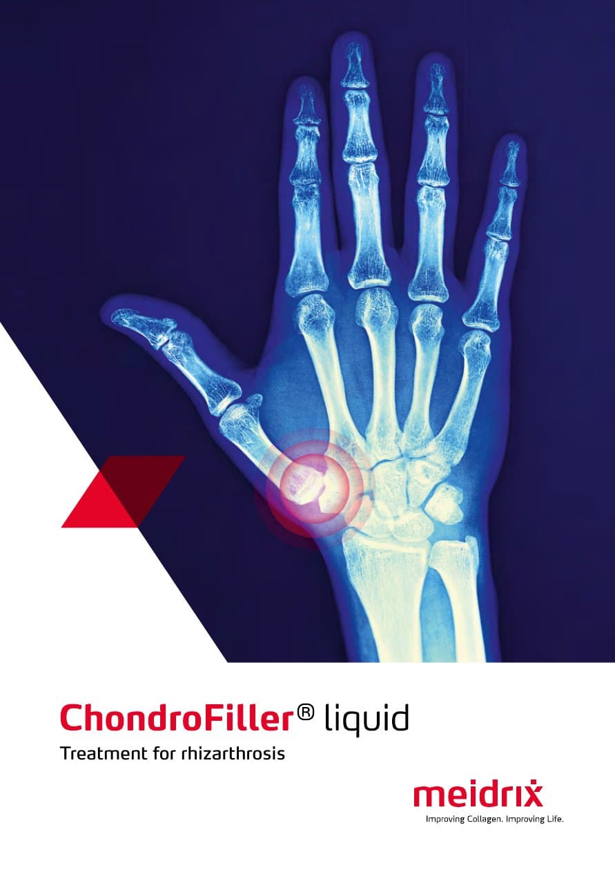 Cover of ChondroFiller® liquid: treatment for rhizarthrosis