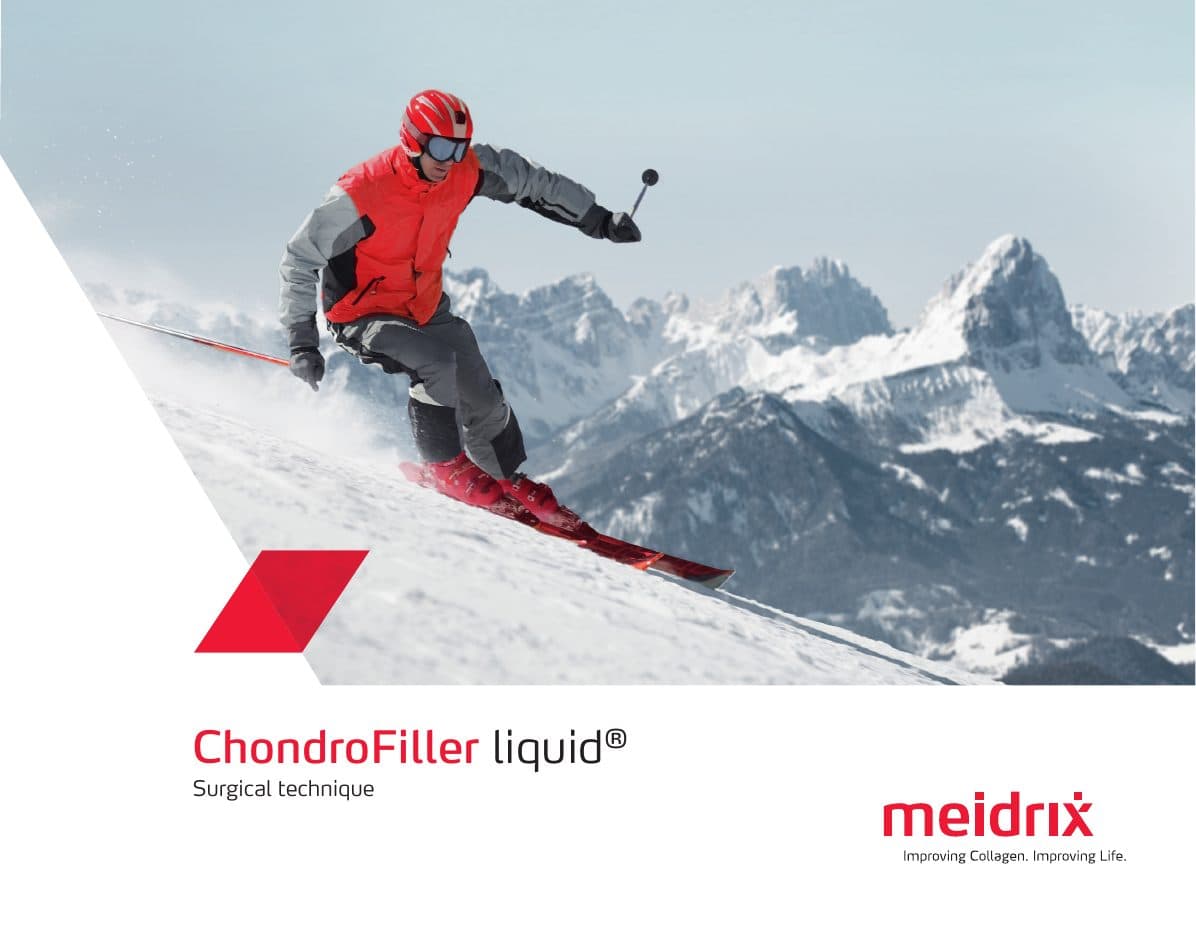 Cover of ChondroFiller® liquid surgical technique