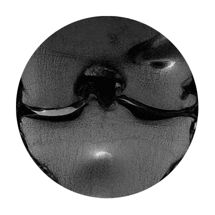 MRI follow-up scan of a knee joint, manufacturer material, view 1